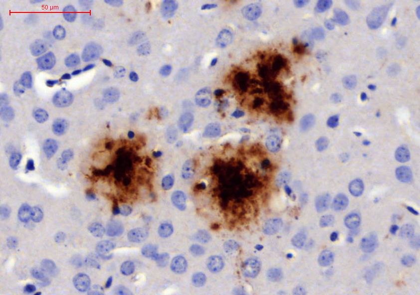 Mouse model with stained Alzheimer plaques